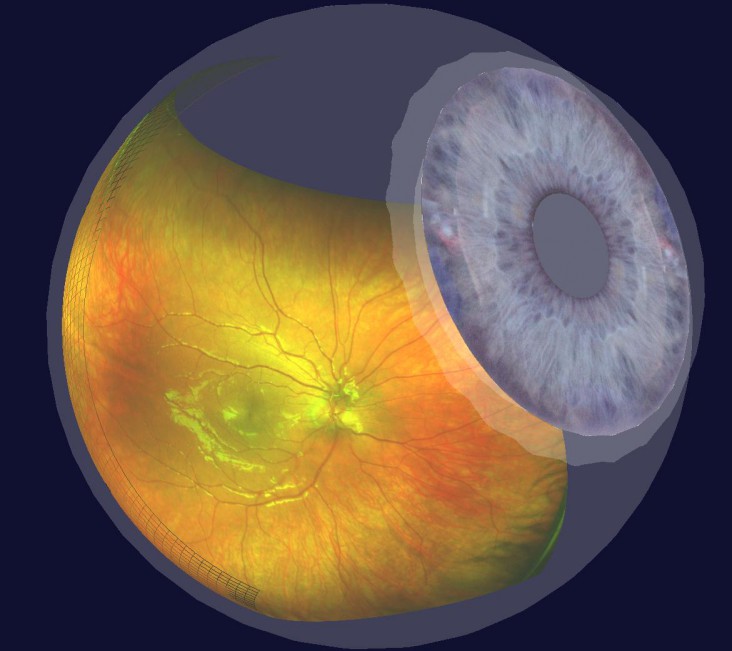 Digital Retinal Examination-2 | Haven Opticals Limited